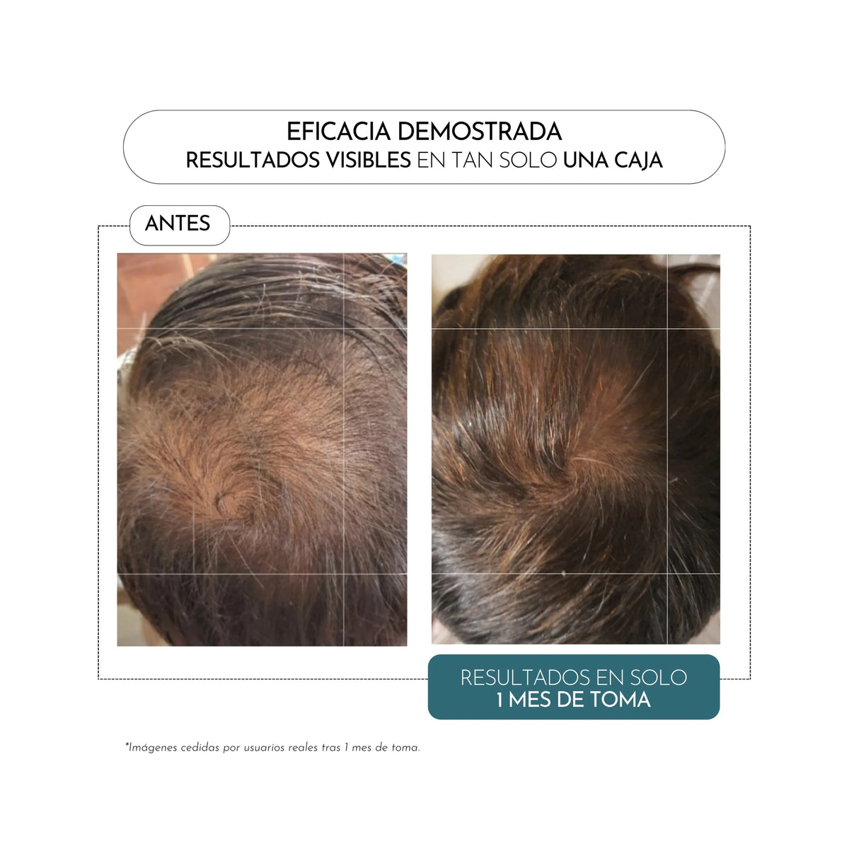 LUXMETIQUE HAIR FÓRMULA 60 CAPS